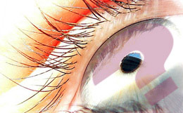 operation laser des yeux